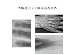 二郎神专业生产便携式X光机服务于医院诊所体检中心等